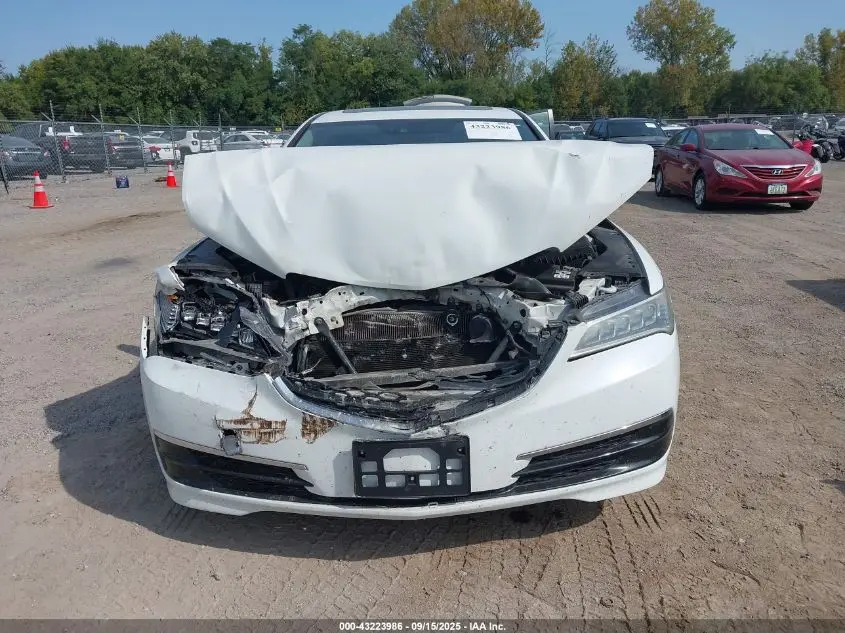 2017 ACURA TLX TECHNOLOGY PACKAGE