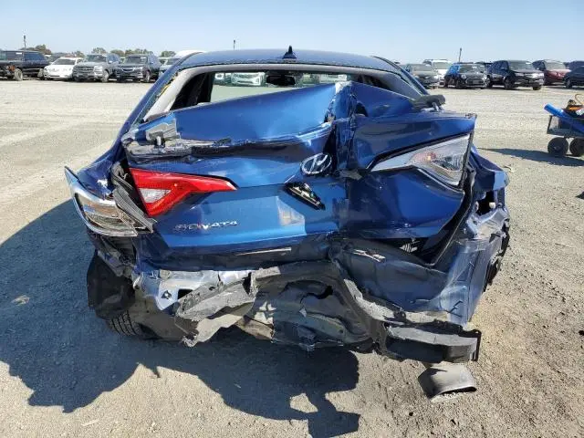 2016 HYUNDAI SONATA SE