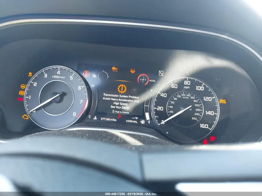 2021 ACURA TLX ADVANCE PACKAGE