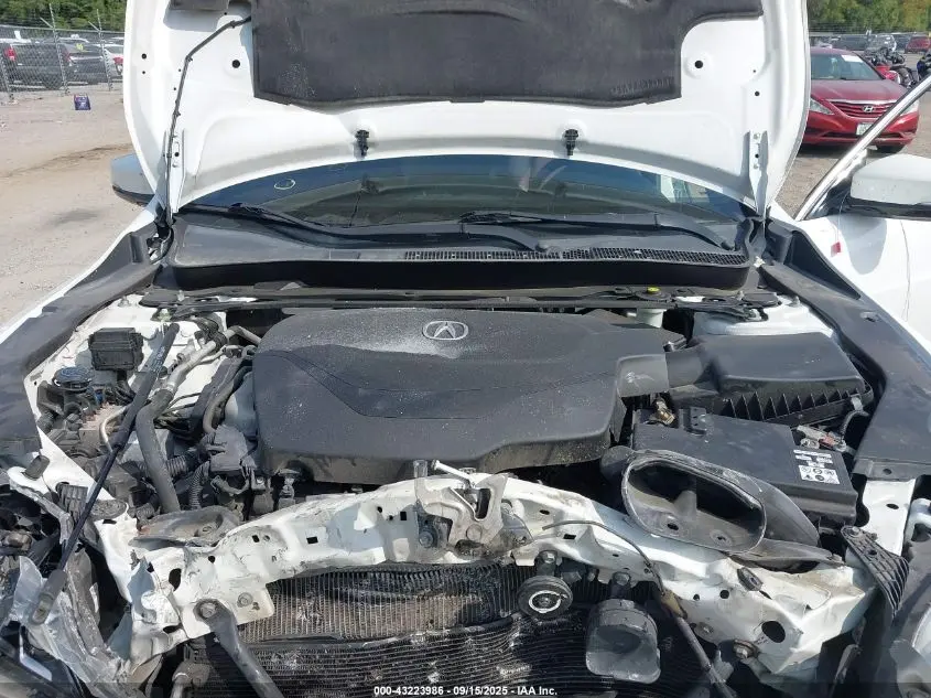 2017 ACURA TLX TECHNOLOGY PACKAGE