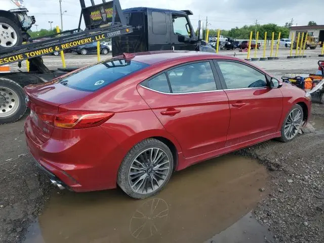 2017 HYUNDAI ELANTRA SPORT