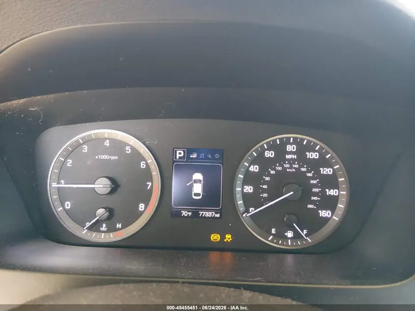 2016 HYUNDAI SONATA SE