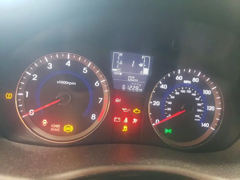 2017 HYUNDAI ACCENT SE  