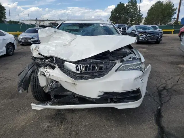 2017 ACURA TLX TECH  