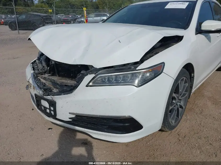 2017 ACURA TLX TECHNOLOGY PACKAGE