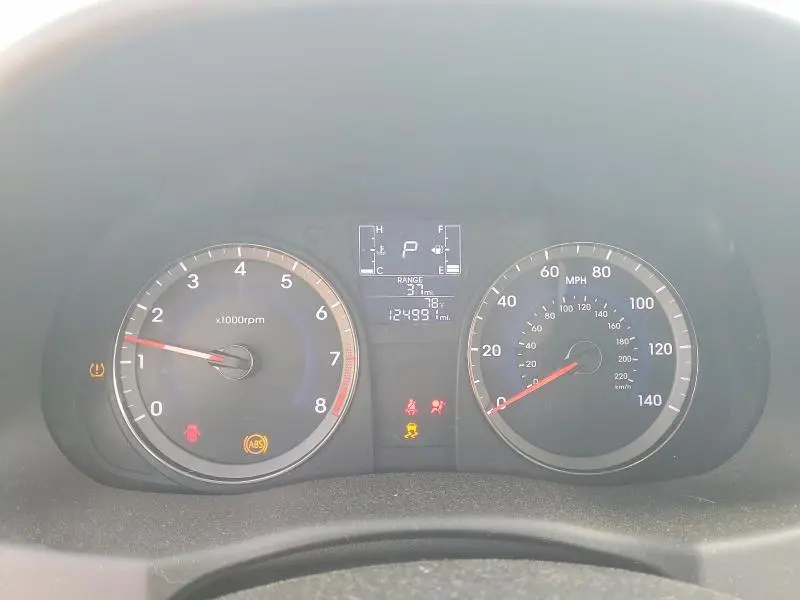 2016 HYUNDAI ACCENT SE  